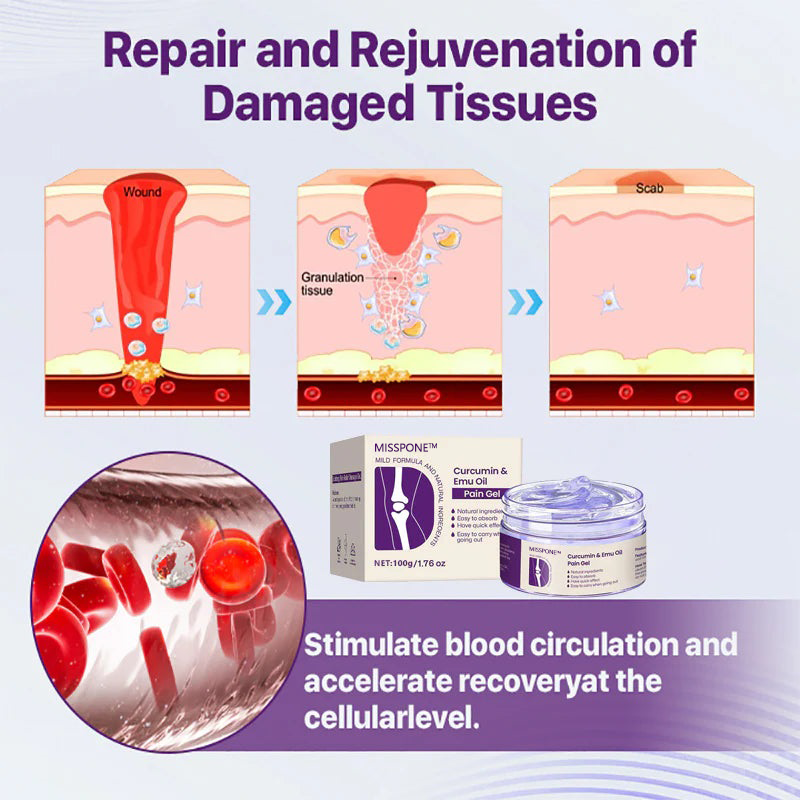 Misspone™ Curcumin & Emu Oil Pain Gel – 🏥Backed by US Osteopathic Experts