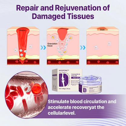 Misspone™ Curcumin & Emu Oil Pain Gel – 🏥Backed by US Osteopathic Experts