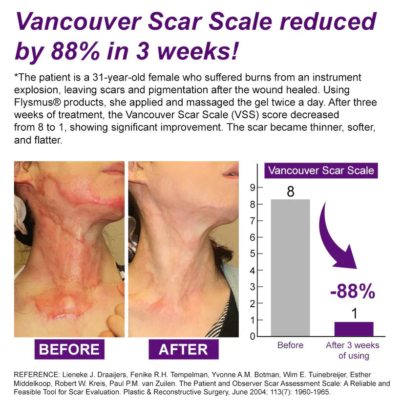 💙 UKCA-Certified ✅Misspone® Scar Gel – Clinically Proven to Fade Surgical, Acne, Burn & Trauma Scars