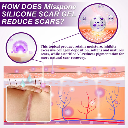 💙 UKCA-Certified ✅Misspone® Scar Gel – Clinically Proven to Fade Surgical, Acne, Burn & Trauma Scars